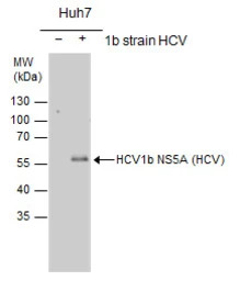 Hepatitis C virus NS5A protein