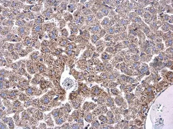 Ceruloplasmin antibody