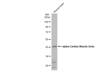 alpha Cardiac Muscle Actin ant
