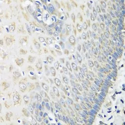 OXCT1 antibody