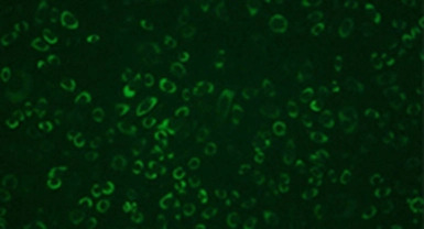 Dengue virus NS1 protein antib