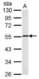 Desmin antibody