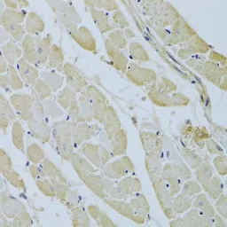 Carbonic Anhydrase III antibod