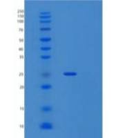 人激肽释放酶1(KLK1)重组蛋白C-6His