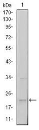 SNAI1 antibody [6D2]