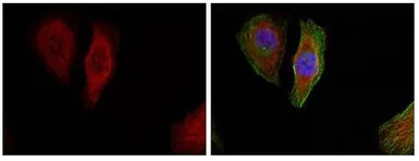 ERK1 (phospho Thr202) + ERK2 (