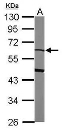 Alpha 2 Antiplasmin antibody [