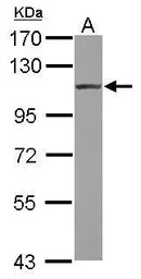 alpha Actinin 4 antibody [N1N2