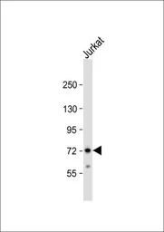 ZFP36 antibody, Internal
