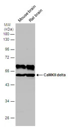 CaMKII delta antibody