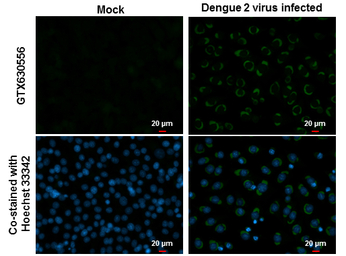 Dengue virus NS1 protein antib