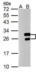 Twist1 antibody [N1C3]