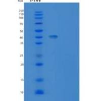 人IL-18受体辅助蛋白/IL-18RAcP/IL-1R7重组蛋白C-6His