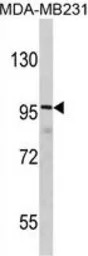 DLGAP1 antibody, N-term