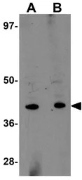 TRESK antibody