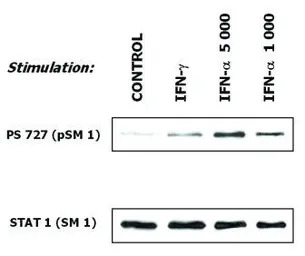 STAT1 antibody [SM1]