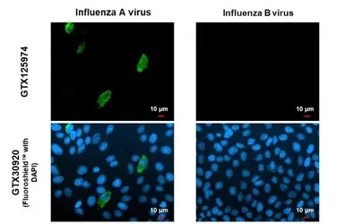 Influenza A virus H1N1 NA (Neu