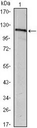 USP7 antibody [5F11]
