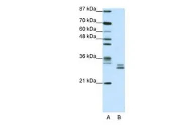 CLIC5 antibody, C-term