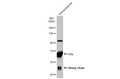C1s antibody