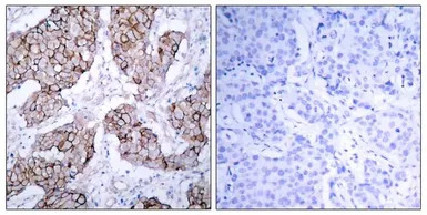 EGFR (phospho Tyr1068) antibod