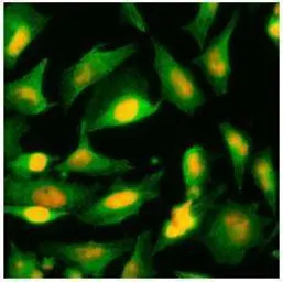 AGXT antibody [AT2T4]