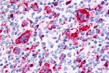 F2RL3 / PAR-4 antibody