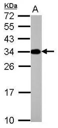 ATP6V1E2 antibody [N1C3]