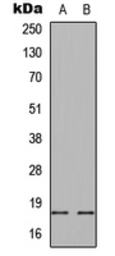 alpha Synuclein (phospho Ser12