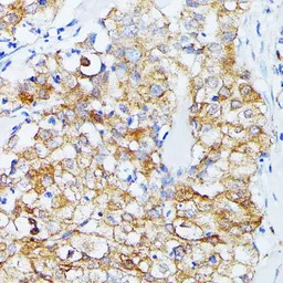 ECE1 antibody
