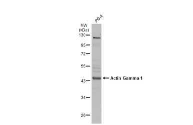 Actin Gamma 1 antibody