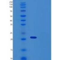 人NKG2D配体2/NKG2DL2/N2DL2重组蛋白C-6His