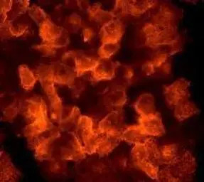 EGFR (phospho Tyr1068) antibod