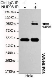 NUP98 antibody [3B8-D7-H10]