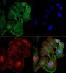 NAK / TBK1 antibody [108A429]