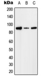 Factor I antibody
