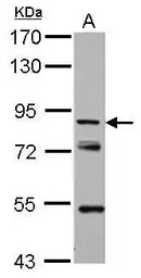 KBTBD3 antibody