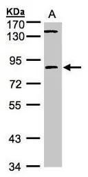 LIM kinase 2 antibody