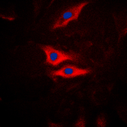 PLA2G4A (phospho Ser505) antib