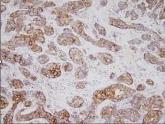 TPD52L1 antibody [d1C5]