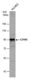 CD105 antibody [N1N3-2]