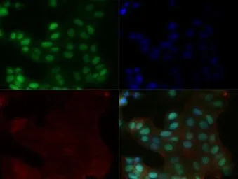 MGMT antibody [MT 23.2]