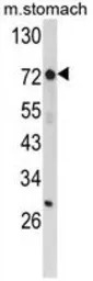 ZFP36 antibody, Internal