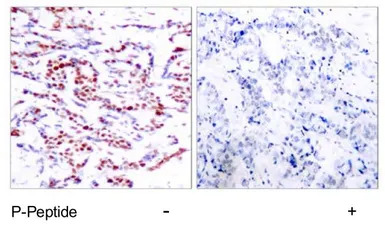 ATF2 (phospho Thr71) antibody