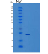 人白细胞介素-25/IL25/MYDGF重组蛋白N-6His