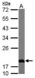 NDUFS4 antibody