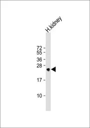 MSRA antibody, N-term