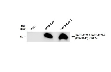 SARS-CoV / SARS-CoV-2 (COVID-1