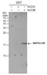 LC3B antibody [GT3612]