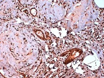 Estrogen Receptor beta 5 antib